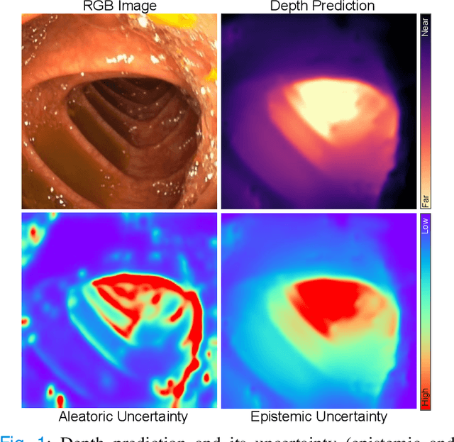 Figure 1 for On the Uncertain Single-View Depths in Endoscopies