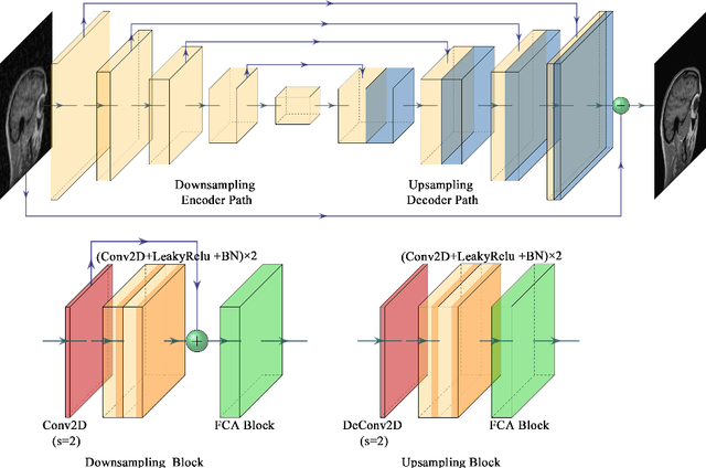 Figure 3 for Edge-Enhanced Dual Discriminator Generative Adversarial Network for Fast MRI with Parallel Imaging Using Multi-view Information