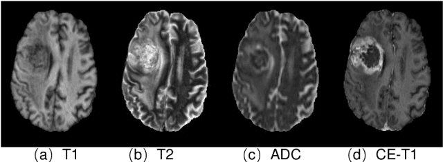 Figure 1 for Contrast-enhanced MRI Synthesis Using 3D High-Resolution ConvNets
