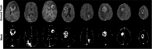 Figure 3 for Contrast-enhanced MRI Synthesis Using 3D High-Resolution ConvNets