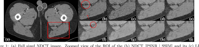 Figure 2 for Deep neural networks-based denoising models for CT imaging and their efficacy