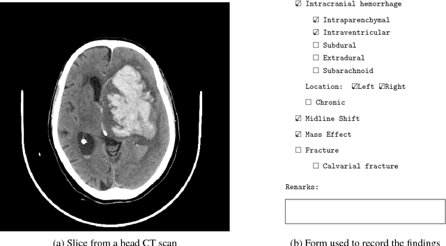 Figure 2 for Development and Validation of Deep Learning Algorithms for Detection of Critical Findings in Head CT Scans