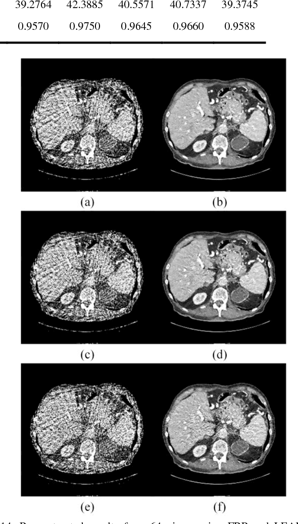 Figure 4 for LEARN: Learned Experts' Assessment-based Reconstruction Network for Sparse-data CT