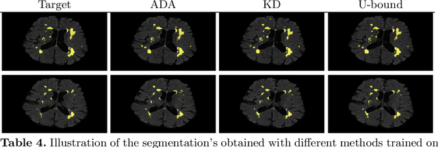 Figure 4 for Knowledge distillation for semi-supervised domain adaptation