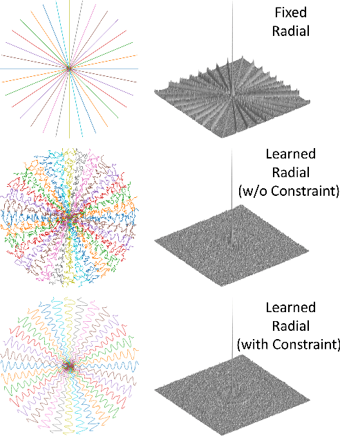 Figure 3 for Learning Optimal K-space Acquisition and Reconstruction using Physics-Informed Neural Networks