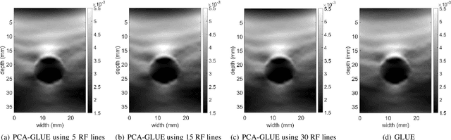 Figure 4 for Fast Approximate Time-Delay Estimation in Ultrasound Elastography Using Principal Component Analysis
