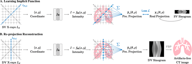 Figure 1 for Self-Supervised Coordinate Projection Network for Sparse-View Computed Tomography