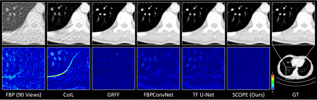 Figure 2 for Self-Supervised Coordinate Projection Network for Sparse-View Computed Tomography