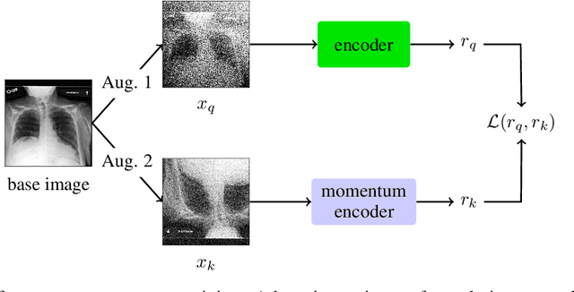 Figure 3 for COVID-19 Deterioration Prediction via Self-Supervised Representation Learning and Multi-Image Prediction