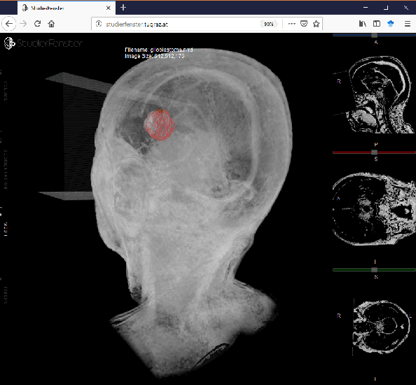 Figure 3 for Client/Server Based Online Environment for Manual Segmentation of Medical Images