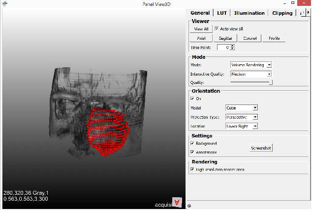 Figure 4 for Client/Server Based Online Environment for Manual Segmentation of Medical Images