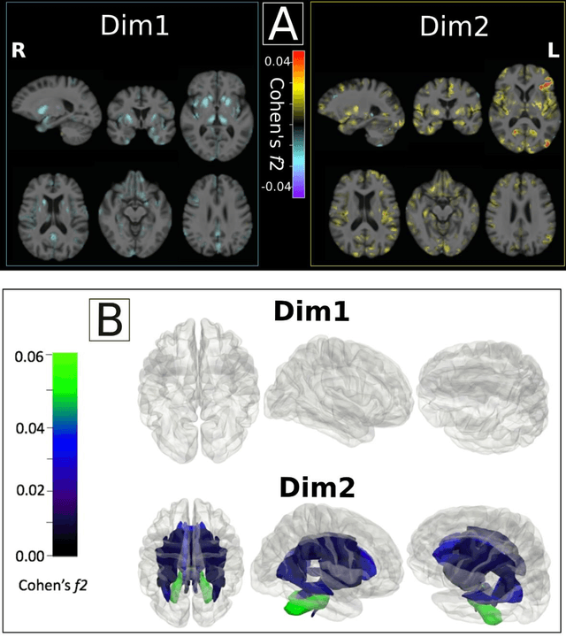 Figure 1 for Multidimensional representations in late-life depression: convergence in neuroimaging, cognition, clinical symptomatology and genetics