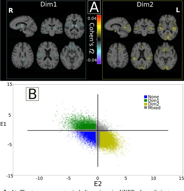 Figure 3 for Multidimensional representations in late-life depression: convergence in neuroimaging, cognition, clinical symptomatology and genetics
