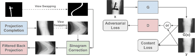 Figure 1 for Generative Mask Pyramid Network for CT/CBCT Metal Artifact Reduction with Joint Projection-Sinogram Correction
