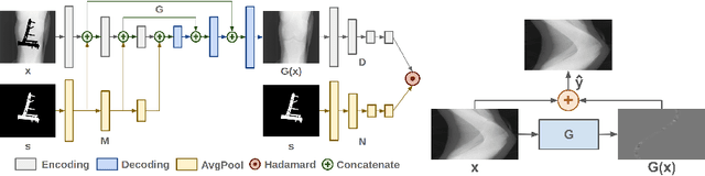 Figure 2 for Generative Mask Pyramid Network for CT/CBCT Metal Artifact Reduction with Joint Projection-Sinogram Correction