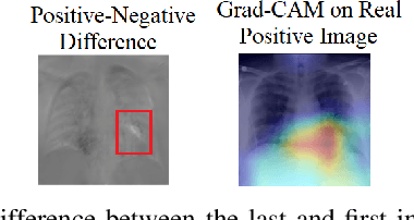 Figure 2 for Visual Explanations for Convolutional Neural Networks via Latent Traversal of Generative Adversarial Networks