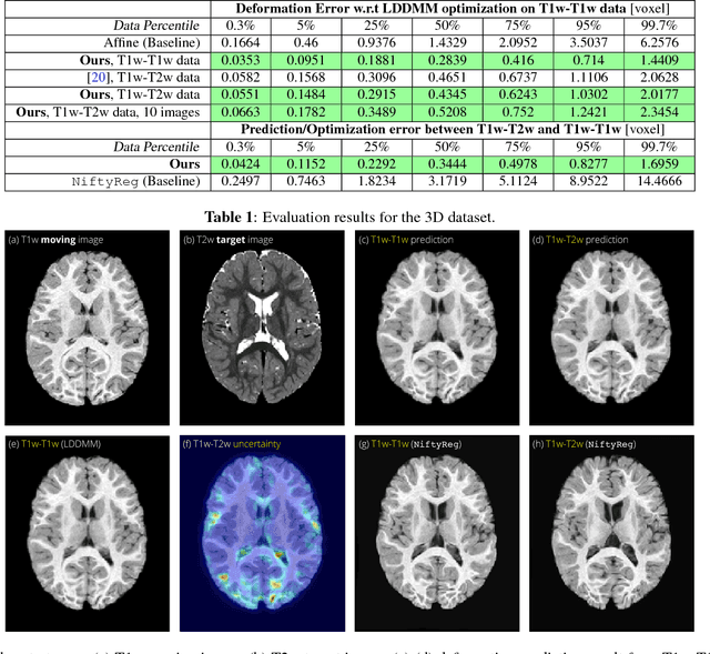 Figure 2 for Fast Predictive Multimodal Image Registration