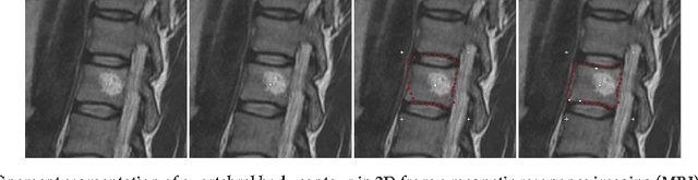 Figure 1 for Refinement-Cut: User-Guided Segmentation Algorithm for Translational Science