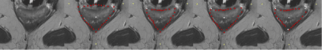 Figure 2 for Refinement-Cut: User-Guided Segmentation Algorithm for Translational Science