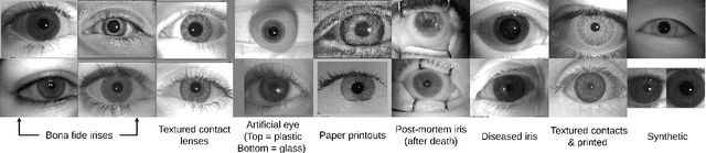 Figure 3 for Human-Aided Saliency Maps Improve Generalization of Deep Learning