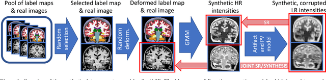 Figure 1 for Joint super-resolution and synthesis of 1 mm isotropic MP-RAGE volumes from clinical MRI exams with scans of different orientation, resolution and contrast