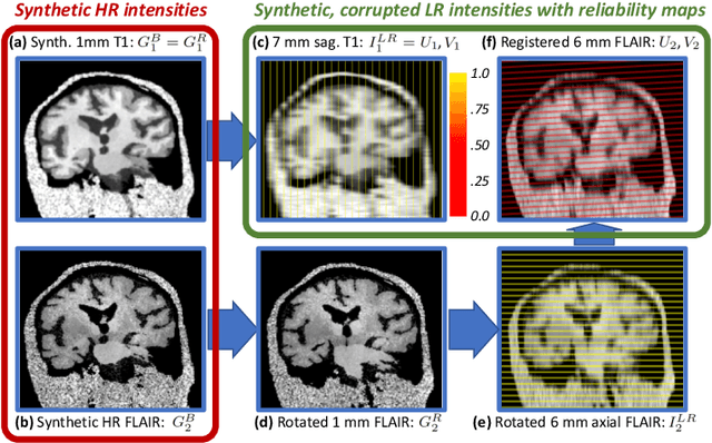 Figure 3 for Joint super-resolution and synthesis of 1 mm isotropic MP-RAGE volumes from clinical MRI exams with scans of different orientation, resolution and contrast