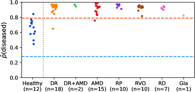 Figure 4 for Detection of multiple retinal diseases in ultra-widefield fundus images using deep learning: data-driven identification of relevant regions