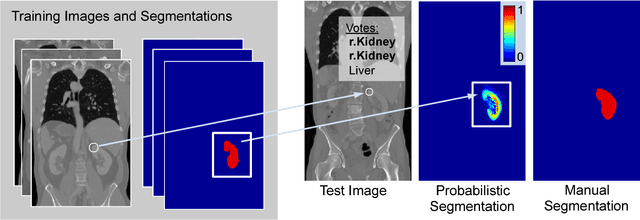 Figure 1 for Keypoint Transfer for Fast Whole-Body Segmentation