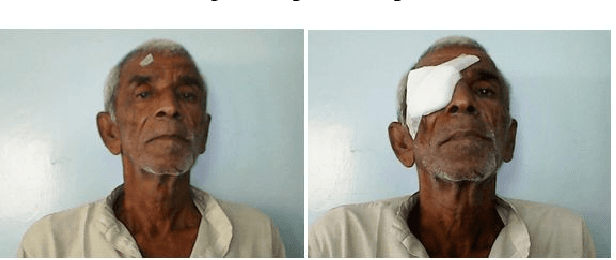 Figure 1 for Face Verification and Forgery Detection for Ophthalmic Surgery Images
