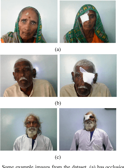 Figure 2 for Face Verification and Forgery Detection for Ophthalmic Surgery Images