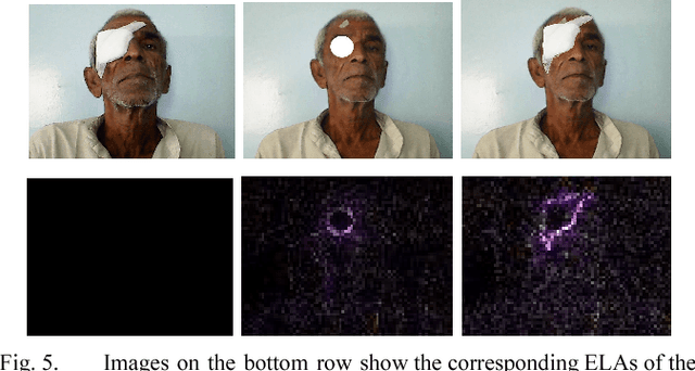 Figure 4 for Face Verification and Forgery Detection for Ophthalmic Surgery Images