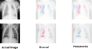 Figure 1 for ViDi: Descriptive Visual Data Clustering as Radiologist Assistant in COVID-19 Streamline Diagnostic