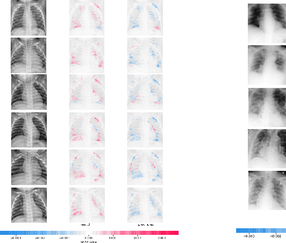 Figure 3 for ViDi: Descriptive Visual Data Clustering as Radiologist Assistant in COVID-19 Streamline Diagnostic