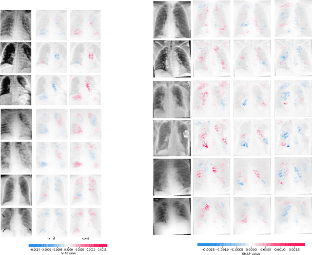 Figure 4 for ViDi: Descriptive Visual Data Clustering as Radiologist Assistant in COVID-19 Streamline Diagnostic