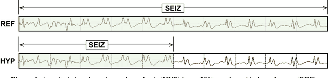 Figure 1 for Objective evaluation metrics for automatic classification of EEG events