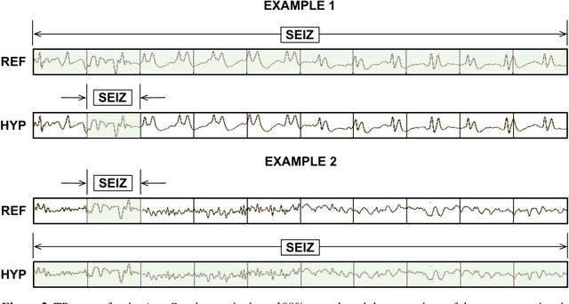 Figure 3 for Objective evaluation metrics for automatic classification of EEG events