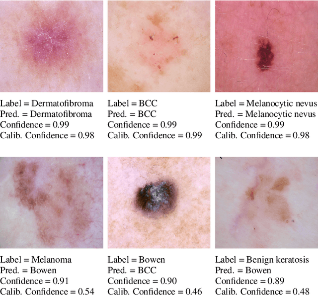 Figure 1 for A New Loss Function for Temperature Scaling to have Better Calibrated Deep Networks