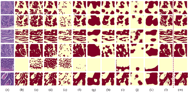 Figure 3 for Transformer based multiple instance learning for weakly supervised histopathology image segmentation