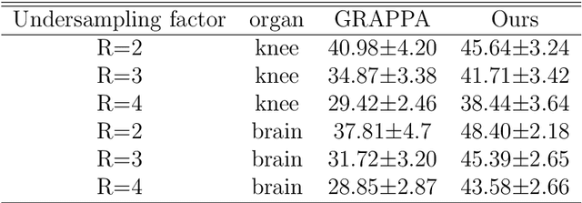 Figure 3 for MRI Reconstruction Using Deep Bayesian Inference