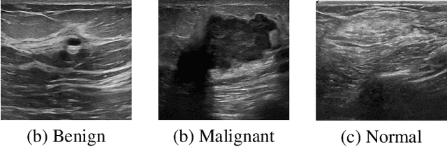 Figure 1 for Vision Transformer for Classification of Breast Ultrasound Images