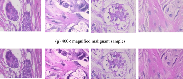 Figure 2 for Stain Normalized Breast Histopathology Image Recognition using Convolutional Neural Networks for Cancer Detection