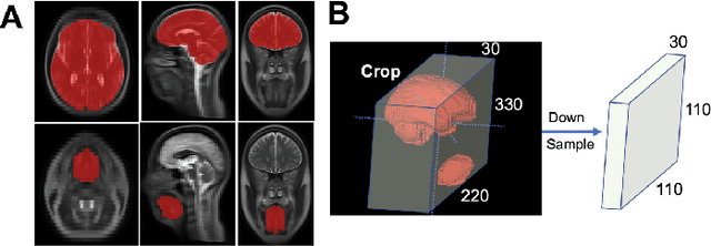 Figure 3 for VoxelHop: Successive Subspace Learning for ALS Disease Classification Using Structural MRI