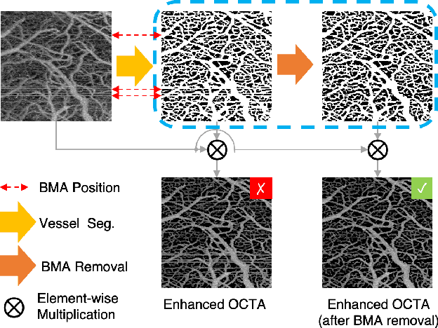 Figure 1 for Self-Supervised Bulk Motion Artifact Removal in Optical Coherence Tomography Angiography