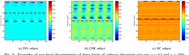 Figure 2 for Individual Recognition in Schizophrenia using Deep Learning Methods with Random Forest and Voting Classifiers: Insights from Resting State EEG Streams