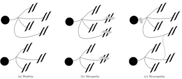 Figure 1 for D{é}composition et analyse de trac{é}s EMG pour aider au diagnostic des maladies neuromusculaires