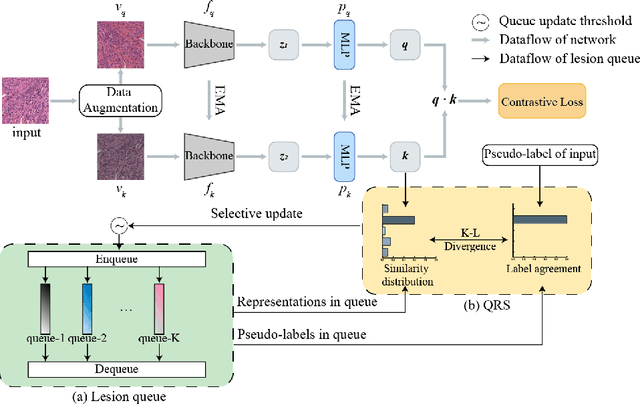 Figure 1 for Lesion-Aware Contrastive Representation Learning for Histopathology Whole Slide Images Analysis