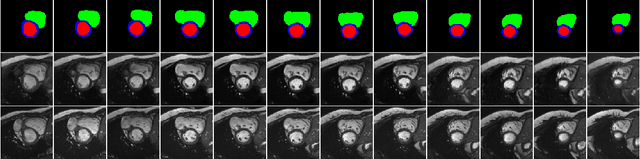 Figure 2 for 4D Semantic Cardiac Magnetic Resonance Image Synthesis on XCAT Anatomical Model