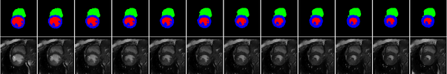 Figure 3 for 4D Semantic Cardiac Magnetic Resonance Image Synthesis on XCAT Anatomical Model