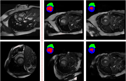 Figure 4 for 4D Semantic Cardiac Magnetic Resonance Image Synthesis on XCAT Anatomical Model