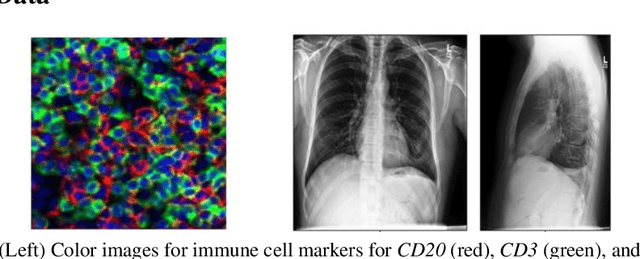 Figure 3 for Emergent symbolic language based deep medical image classification